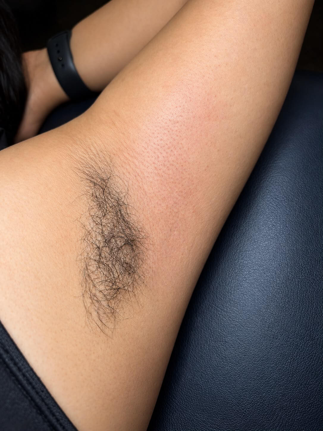 Armpit hair in the process of being removed